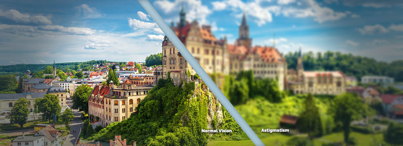 Astigmatism Treatment in Elgin
